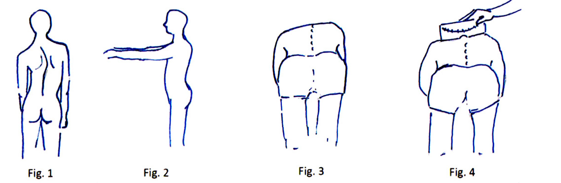 figura 1