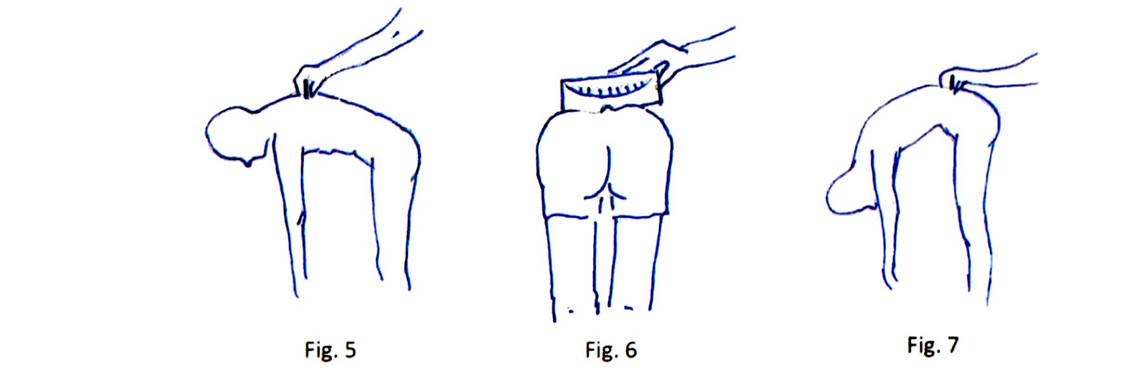 figura 2