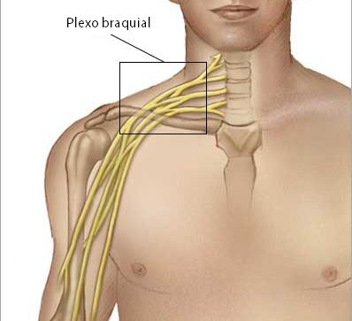 plexo braquial