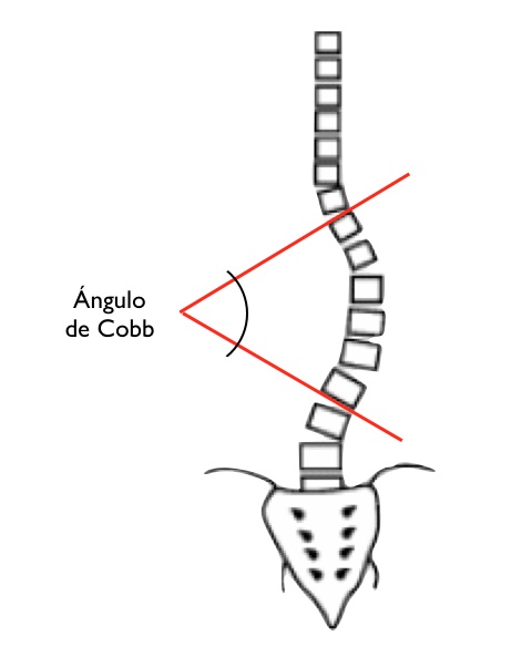 angulo de cobb