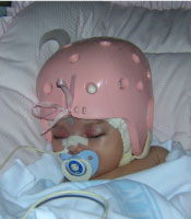 baby with a pink helmet in the hospital