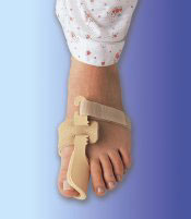 pie con una ortesis de hallux valgus