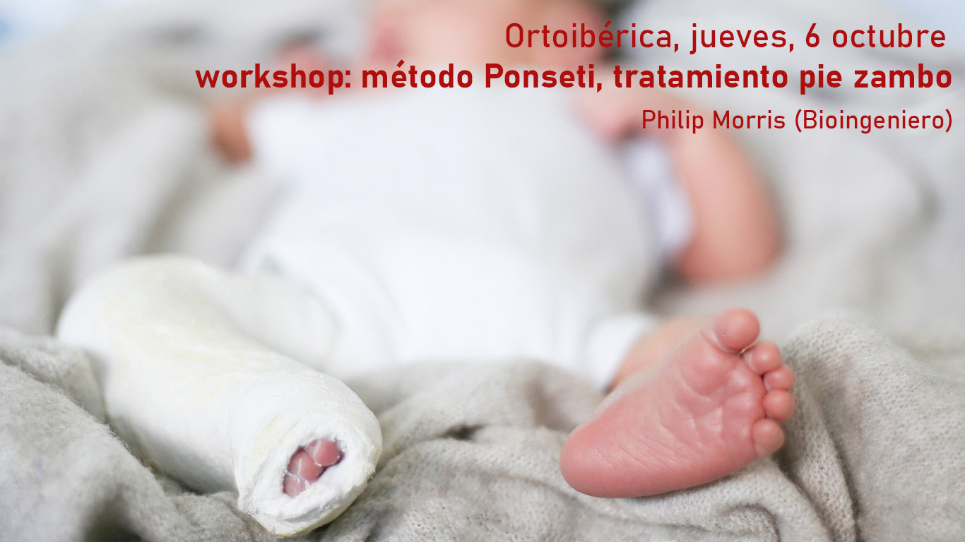 Workshop: método Ponseti